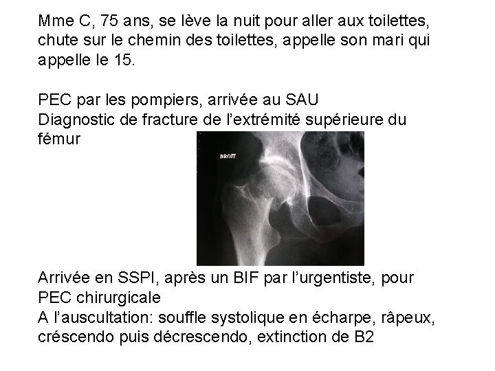 Mme C, 75 ans, se lève la nuit pour aller aux toilettes, chute sur