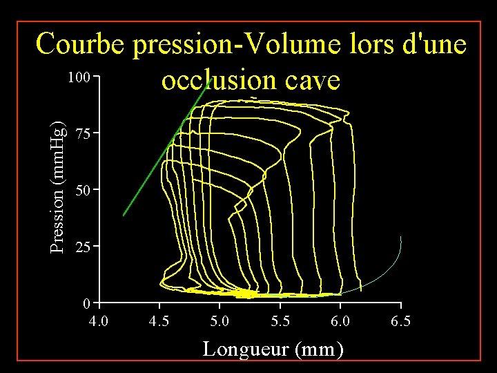 Pression (mm. Hg) Courbe pression-Volume lors d'une 100 occlusion cave 75 50 25 0 Pression (mm. Hg) Courbe pression-Volume lors d'une 100 occlusion cave 75 50 25 0
