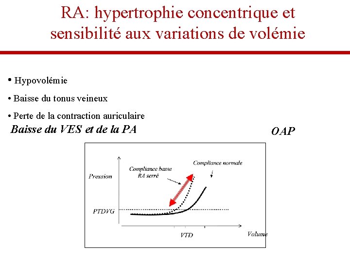 RA: hypertrophie concentrique et sensibilité aux variations de volémie • Hypovolémie • Baisse du