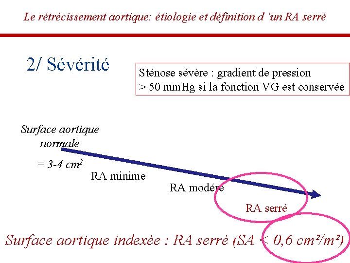 Le rétrécissement aortique: étiologie et définition d ’un RA serré 2/ Sévérité Sténose sévère