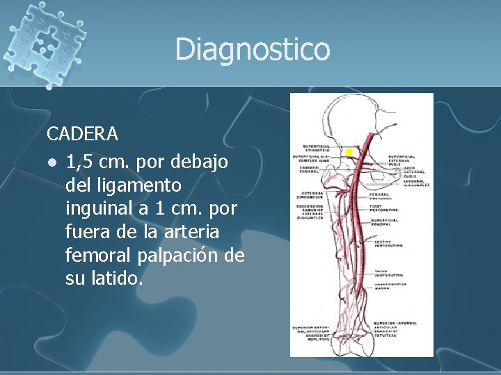 Diagnostico CADERA l 1, 5 cm. por debajo del ligamento inguinal a 1 cm.