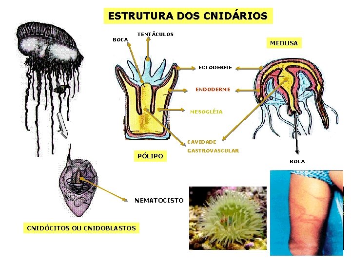 ESTRUTURA DOS CNIDÁRIOS TENTÁCULOS BOCA MEDUSA ECTODERME ENDODERME MESOGLÉIA CAVIDADE PÓLIPO NEMATOCISTO CNIDÓCITOS OU
