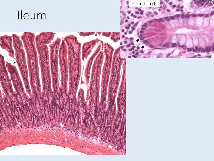 Paneth cells Ileum 