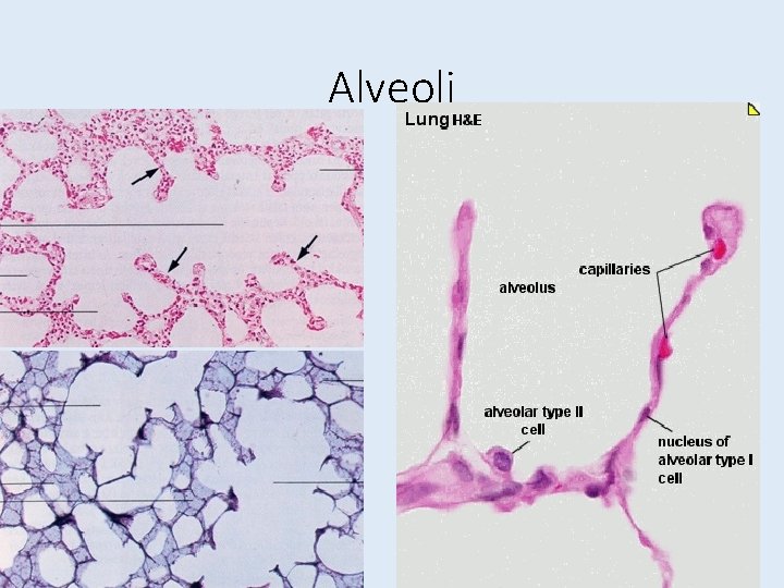 Alveoli 