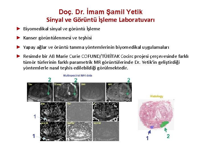  Doç. Dr. İmam Şamil Yetik Sinyal ve Görüntü İşleme Laboratuvarı ► Biyomedikal sinyal