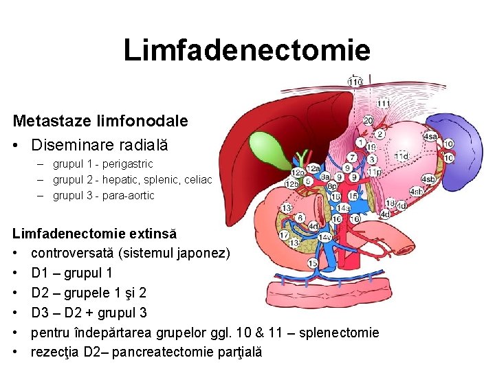 Limfadenectomie Metastaze limfonodale • Diseminare radială – grupul 1 - perigastric – grupul 2
