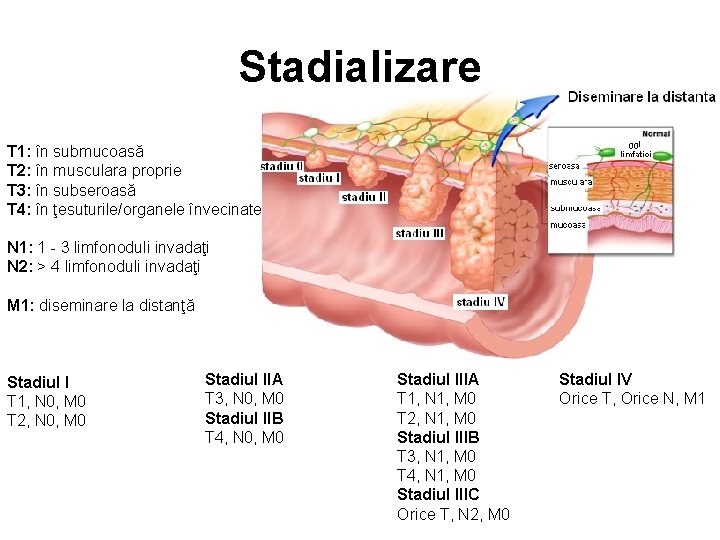 Stadializare T 1: în submucoasă T 2: în musculara proprie T 3: în subseroasă
