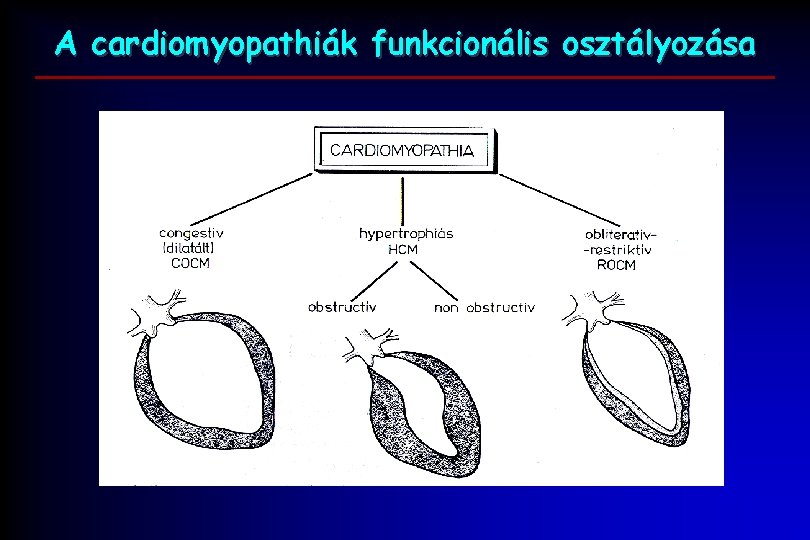 A cardiomyopathiák funkcionális osztályozása 