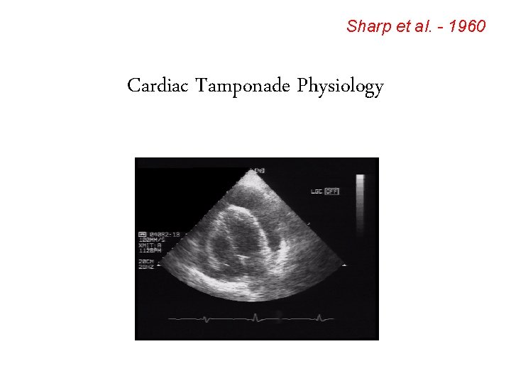 Sharp et al. - 1960 Cardiac Tamponade Physiology 