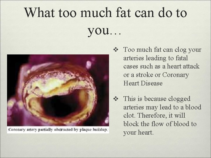 What too much fat can do to you… v Too much fat can clog