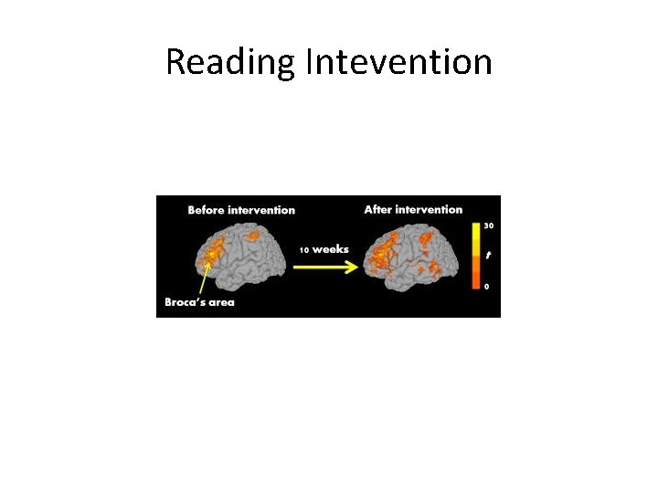 Reading Intevention 