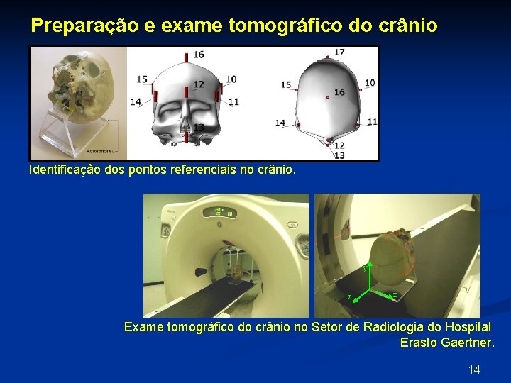 Preparação e exame tomográfico do crânio Identificação dos pontos referenciais no crânio. y z