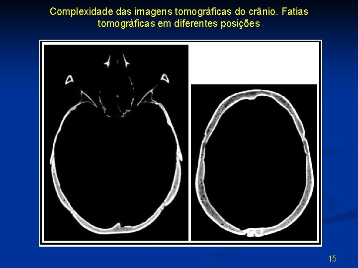 Complexidade das imagens tomográficas do crânio. Fatias tomográficas em diferentes posições 15 