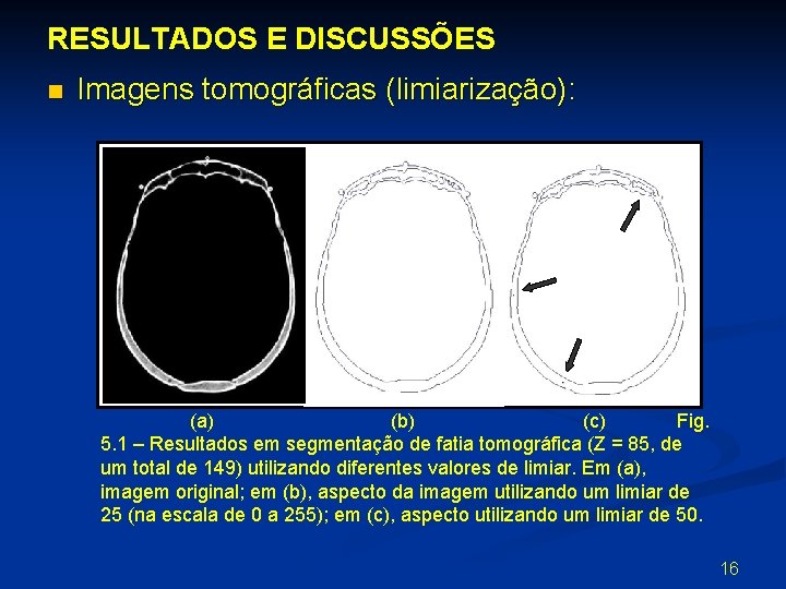 RESULTADOS E DISCUSSÕES n Imagens tomográficas (limiarização): (a) (b) (c) Fig. 5. 1 –