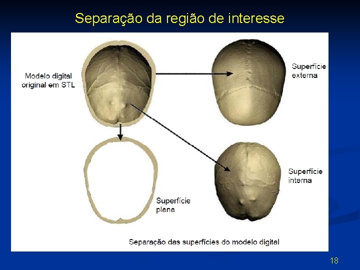 Separação da região de interesse 18 