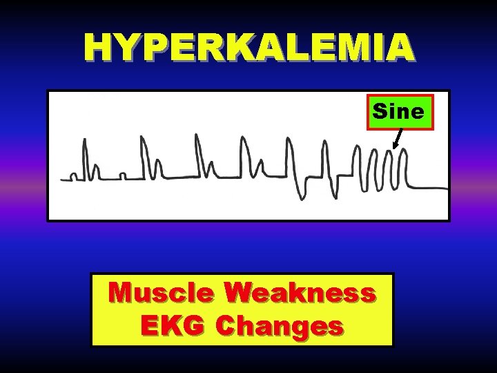 HYPERKALEMIA Sine Muscle Weakness EKG Changes 