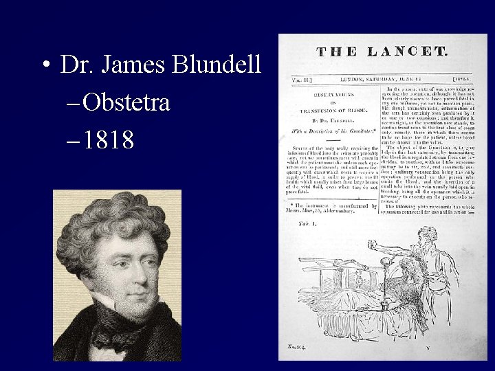  • Dr. James Blundell – Obstetra – 1818 