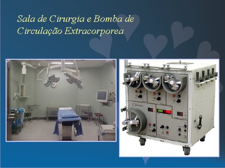 Sala de Cirurgia e Bomba de Circulação Extracorporea 