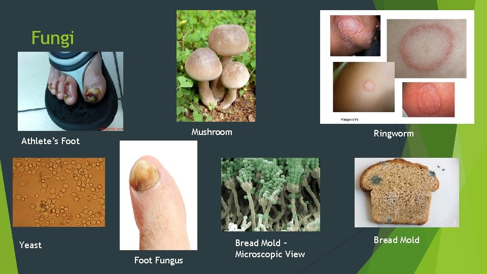 Fungi Mushroom Athlete’s Foot Yeast Foot Fungus Ringworm Bread Mold – Microscopic View Bread