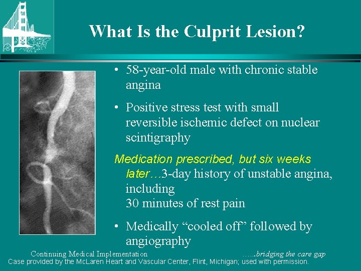 What Is the Culprit Lesion? • 58 -year-old male with chronic stable angina •