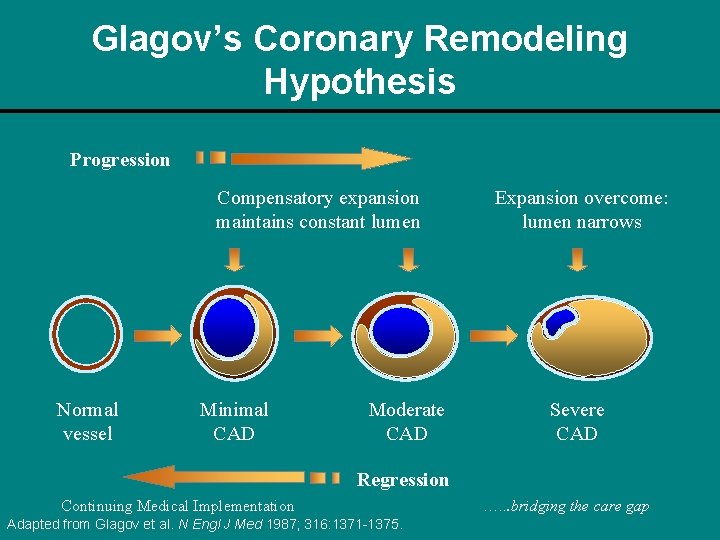 Glagov’s Coronary Remodeling Hypothesis Progression Compensatory expansion maintains constant lumen Normal vessel Minimal CAD