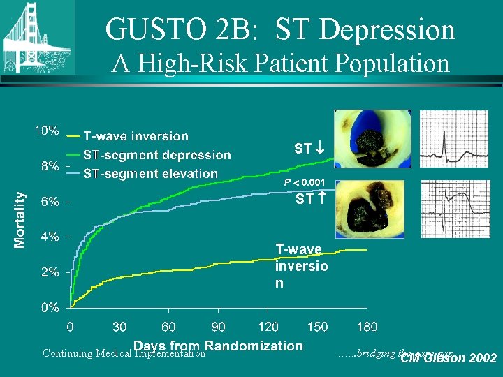 GUSTO 2 B: ST Depression A High-Risk Patient Population ST P 0. 001 ST