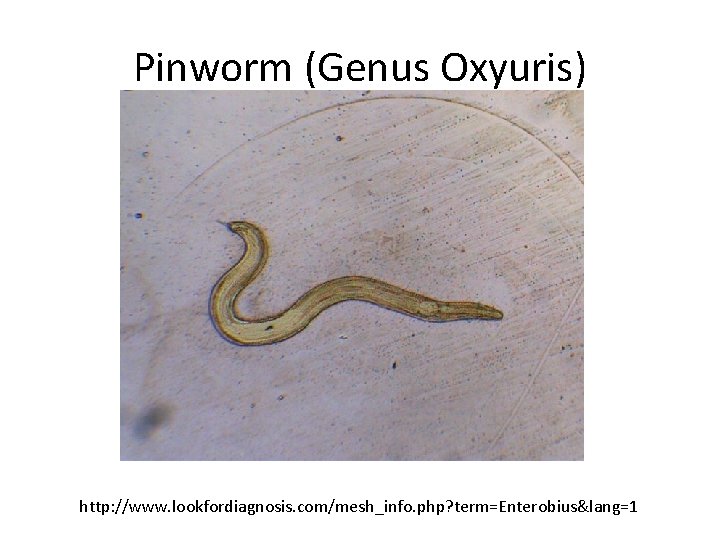 Pinworm (Genus Oxyuris) http: //www. lookfordiagnosis. com/mesh_info. php? term=Enterobius&lang=1 