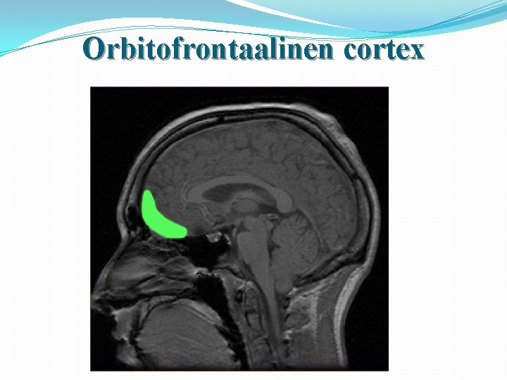 Orbitofrontaalinen cortex 