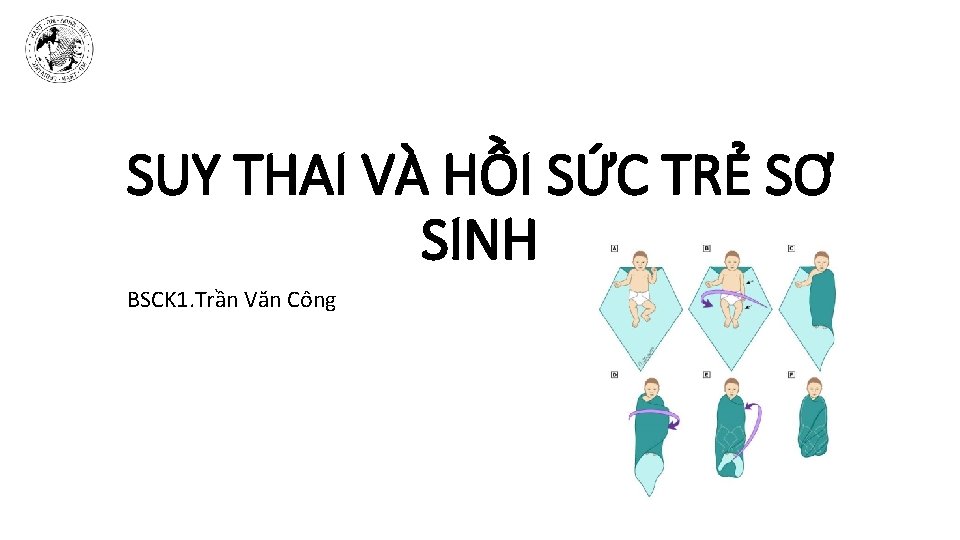 SUY THAI VÀ HỒI SỨC TRẺ SƠ SINH BSCK 1. Trần Văn Công 