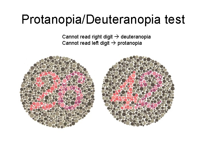 Protanopia/Deuteranopia test Cannot read right digit deuteranopia Cannot read left digit protanopia 
