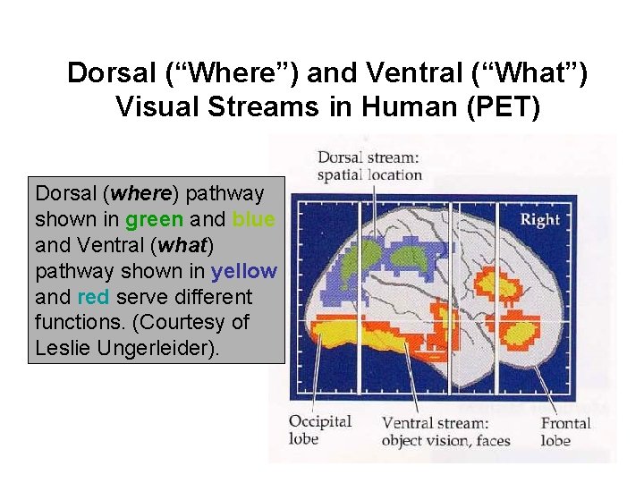Dorsal (“Where”) and Ventral (“What”) Visual Streams in Human (PET) Dorsal (where) pathway shown