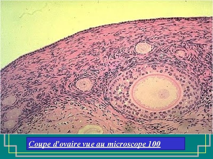 Coupe d'ovaire vue au microscope 100 