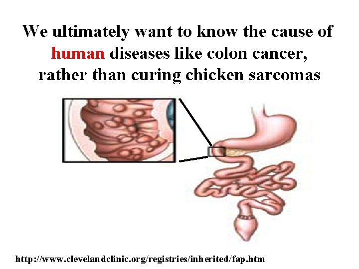 We ultimately want to know the cause of human diseases like colon cancer, rather