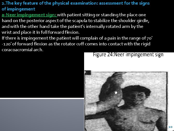 2. The key feature of the physical examination: assessment for the signs of impingement