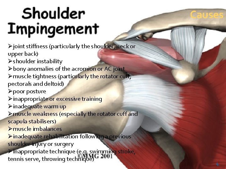 Causes Øjoint stiffness (particularly the shoulder, neck or upper back) Øshoulder instability Øbony anomalies Causes Øjoint stiffness (particularly the shoulder, neck or upper back) Øshoulder instability Øbony anomalies
