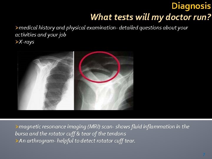 Diagnosis What tests will my doctor run? Ømedical history and physical examination- detailed questions