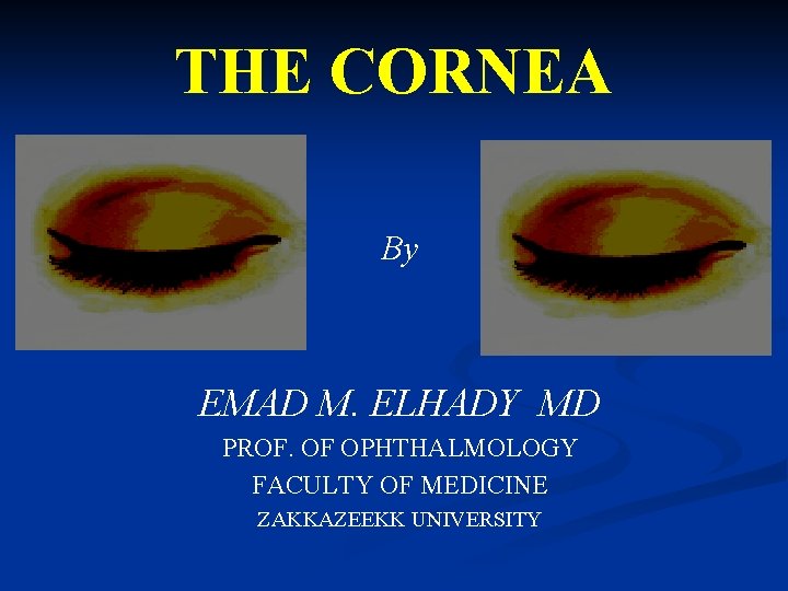 THE CORNEA By EMAD M. ELHADY MD PROF. OF OPHTHALMOLOGY FACULTY OF MEDICINE ZAKKAZEEKK