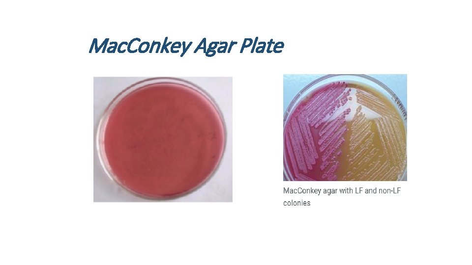 Mac. Conkey Agar Plate 