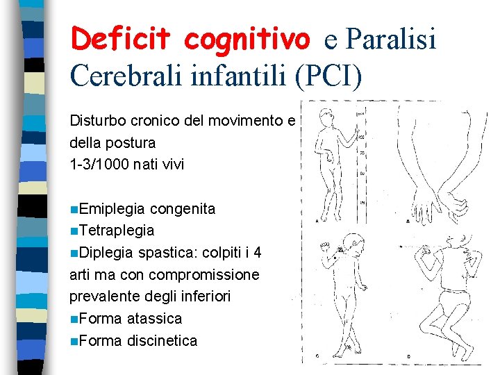 Deficit cognitivo e Paralisi Cerebrali infantili (PCI) Disturbo cronico del movimento e della postura Deficit cognitivo e Paralisi Cerebrali infantili (PCI) Disturbo cronico del movimento e della postura