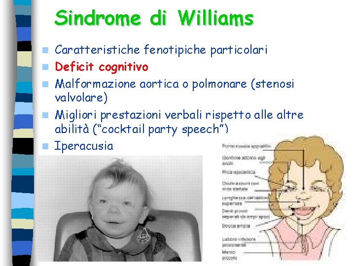 Sindrome di Williams n n n Caratteristiche fenotipiche particolari Deficit cognitivo Malformazione aortica o Sindrome di Williams n n n Caratteristiche fenotipiche particolari Deficit cognitivo Malformazione aortica o