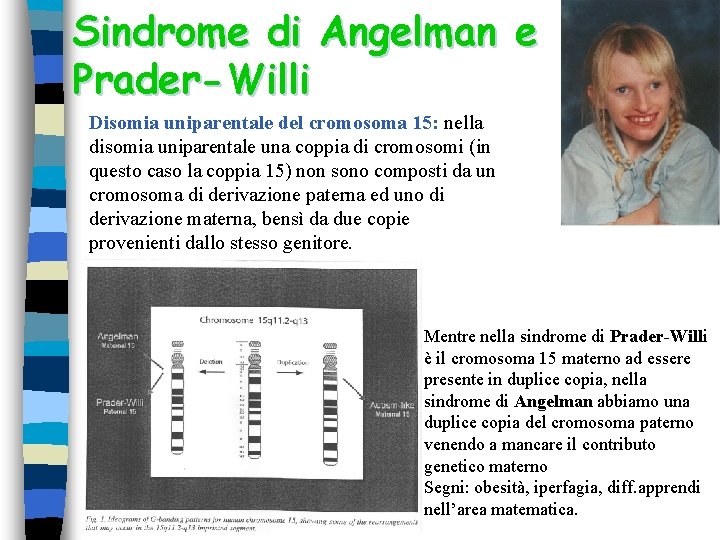 Sindrome di Angelman e Prader-Willi Disomia uniparentale del cromosoma 15: nella disomia uniparentale una Sindrome di Angelman e Prader-Willi Disomia uniparentale del cromosoma 15: nella disomia uniparentale una