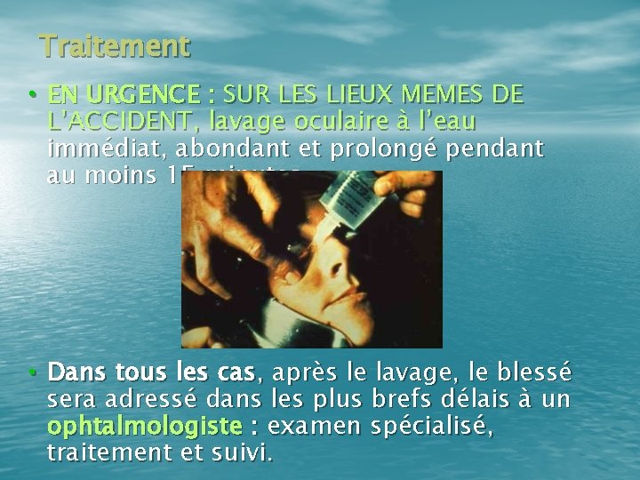 Traitement • EN URGENCE : SUR LES LIEUX MEMES DE L’ACCIDENT, lavage oculaire à