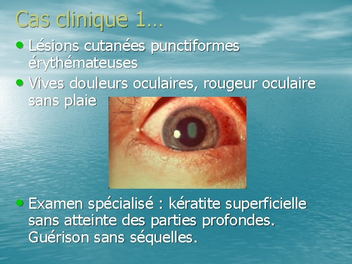 Cas clinique 1… • Lésions cutanées punctiformes érythémateuses • Vives douleurs oculaires, rougeur oculaire