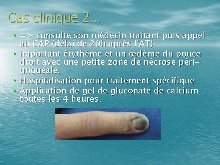 Cas clinique 2… • => consulte son médecin traitant puis appel au CAP (délai