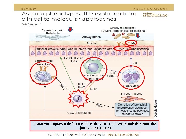 Esquema propuesto de factores en el desarrollo de asma asociada a Non-Th 2 (Inmunidad