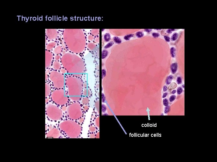 Thyroid follicle structure: colloid follicular cells Thyroid follicle structure: colloid follicular cells
