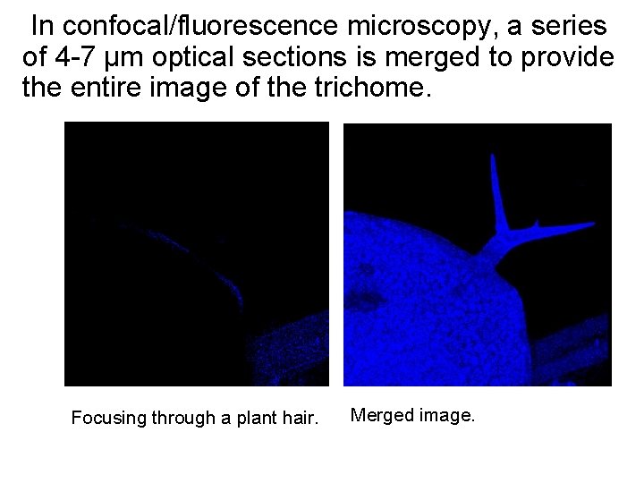 In confocal/fluorescence microscopy, a series of 4 -7 µm optical sections is merged to