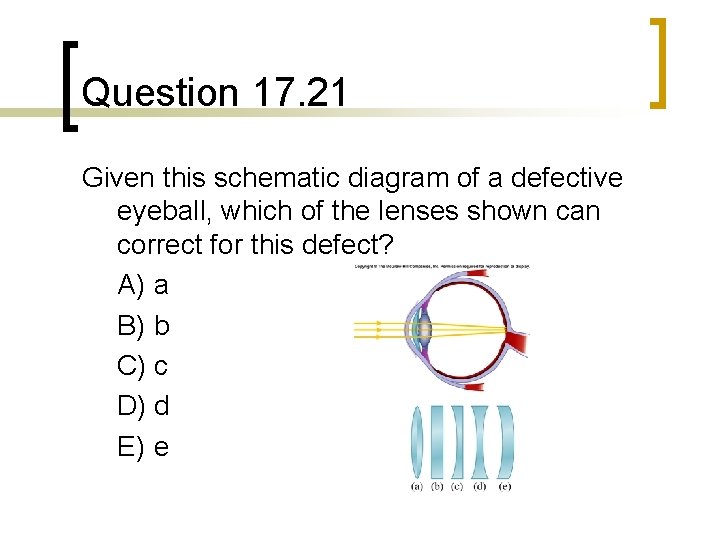 Question 17. 21 Given this schematic diagram of a defective eyeball, which of the