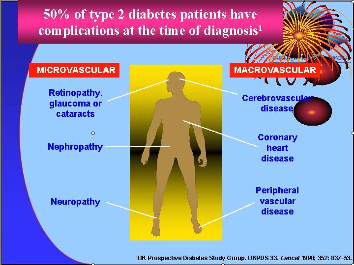 50% of type 2 diabetes patients have complications at the time of diagnosis 1
