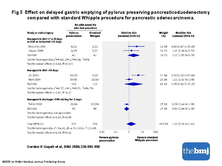 Fig 3 Effect on delayed gastric emptying of pylorus preserving pancreaticoduodenectomy compared with standard Whipple